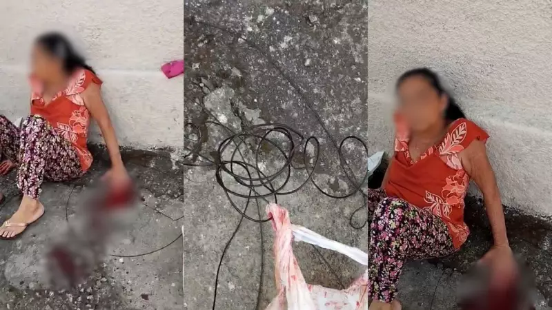 Idosa tem dedos decepados por fiação elétrica solta em Divinópolis; veja o vídeo chocante