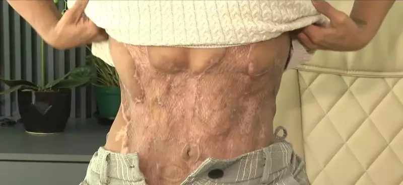 Médico de SC Condenado por 'X-Tudo': Entenda o Combo de Cirurgias Plásticas que Levou à Morte de Paciente