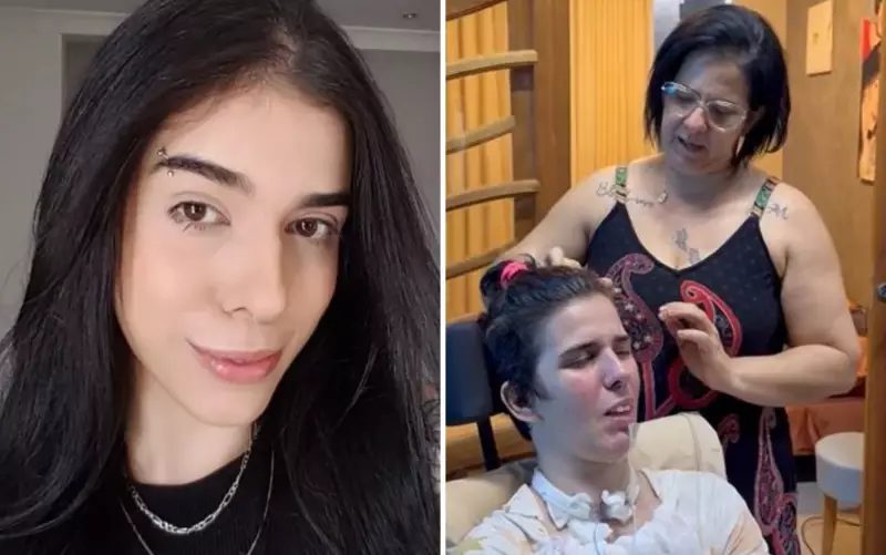 Mãe Desabafa: 'São os 1.000 Dias Mais Doloridos da Minha Vida' Após Filha Ter Reação Grave a Pimenta