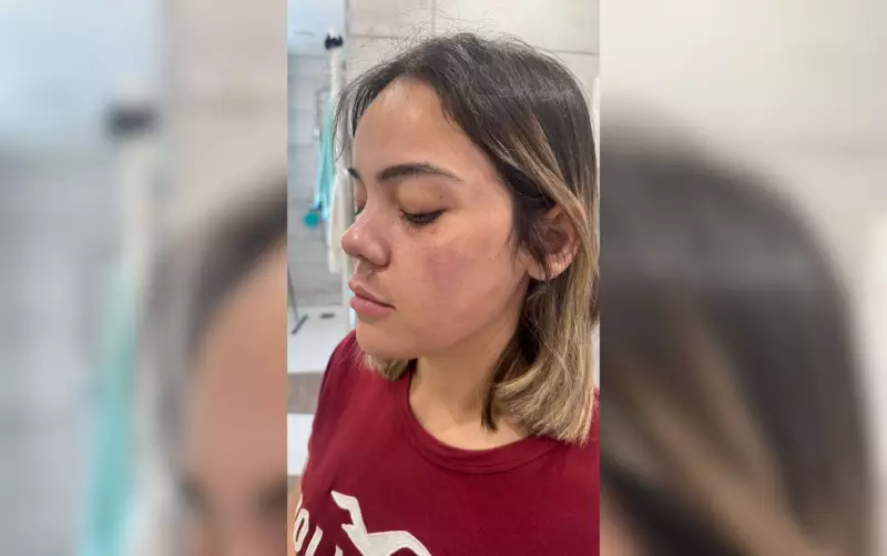 Mulher sofre tentativa de estupro no metrô e é mordida no lábio; irmão relata trauma