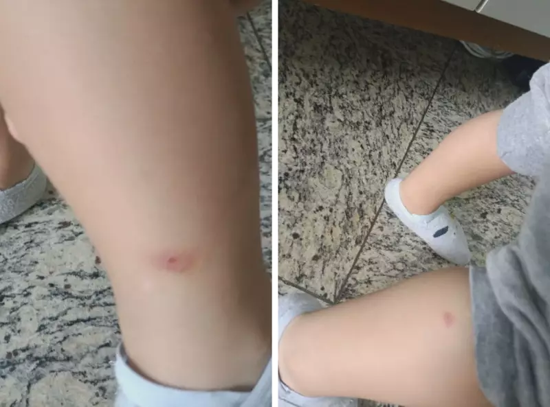 Pais em Alerta: Infestação de Piolhos e Carrapatos Assola Creche no Rio - 'Situação Insustentável'