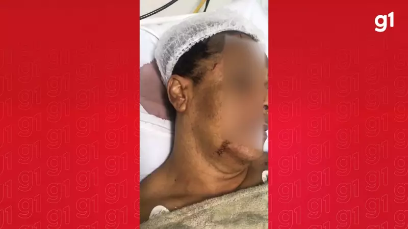 Tentativa de Feminicídio: Mulher Trans Sobrevive a Ataque Brutal em Madre de Deus