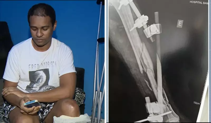 Vida Transformada em Segundos: Vítima de Atropelamento Enfrenta 1 Ano de Recuperação