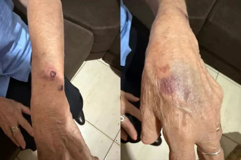 Vizinha Salva Idosa de Cativeiro Doméstico: Filha é Presa por Tortura no Paraná