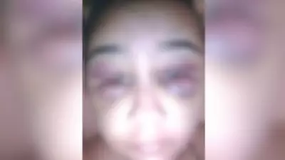 Jovem sofre agressão brutal do ex-namorado por quase 2 horas em MG: 'Pensei que ia morrer'