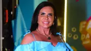 Gretchen revela batalha contra a alopecia: 'Estou me redescobrindo'