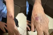 Vizinha Salva Idosa de Cativeiro Doméstico: Filha é Presa por Tortura no Paraná