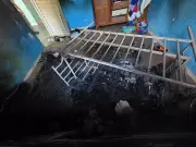 Vítima de violência doméstica: homem queimado pela companheira enquanto dormia permanece em estado gravíssimo