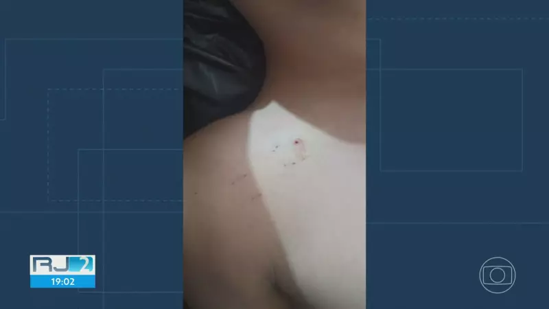 Alerta no RJ: Acidentes com Animais Peçonhentos Disparam em 2025 | Saiba Como se Proteger