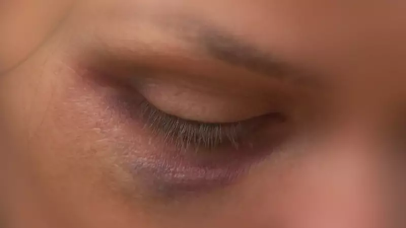 Feminicídio: Especialistas Alertam que Relacionamentos Tóxicos São o Primeiro Sinal da Violência Contra a Mulher