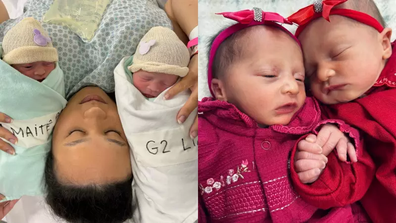 Gêmeas nascem de parto empelicado raro em Sorocaba; uma teve complicações