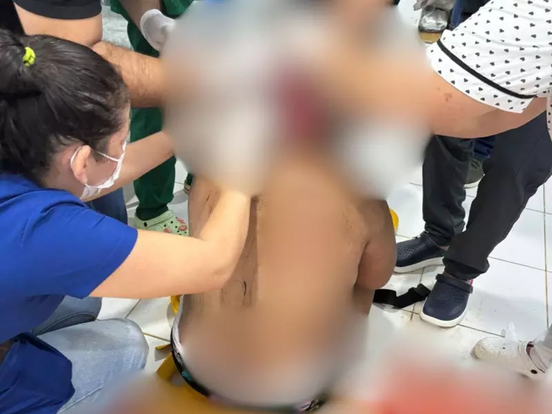 Jovem indígena sofre escalpelamento em máquina no Acre