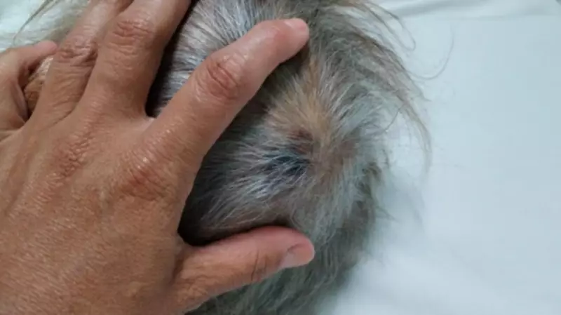 Justiça obriga Jaguariúna a custear internação de idosa em instituição privada após suspeita de queda na UTI municipal