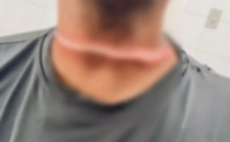 Motociclista tem pescoço atingido por fio em cruzamento de Aracaju