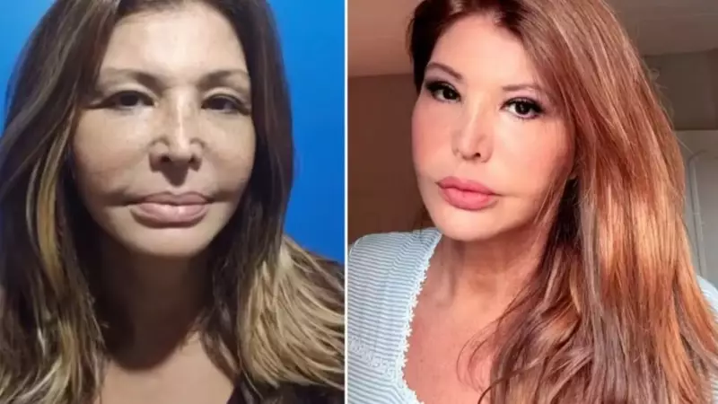 Musa dos anos 90 revela segredos da harmonização facial: 'Me sinto renovada'