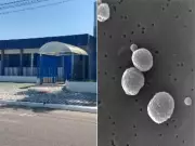 Alerta em Praia Grande: Segundo caso de meningite bacteriana é confirmado após morte de menina