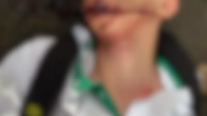 Ciclista de 16 anos tem pescoço cortado por fio de internet solto em Uberlândia