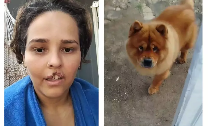 Mulher reconstrói vida após ter lábio arrancado por cachorro da raça chow-chow em RO