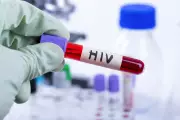 Caso raro: paciente com HIV em remissão há 6 anos após transplante sem mutação completa
