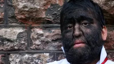 5 doenças raras reais que parecem ficção científica