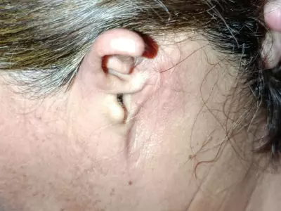 Ataque de rottweilers: 9 meses depois, vítima evita espelho e luta por casa própria