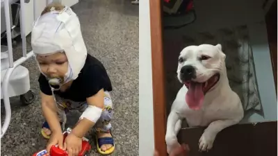 Bebê de 1 ano e 8 meses é atacado por cachorro da família no ES
