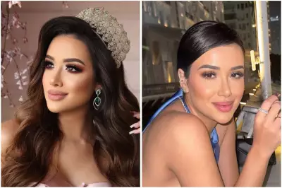 Candidata ao BBB 26 revela gastos de R$ 40 mil em estética