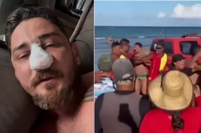 Empresário agredido em Porto de Galinhas passa por cirurgia após 4 fraturas no rosto