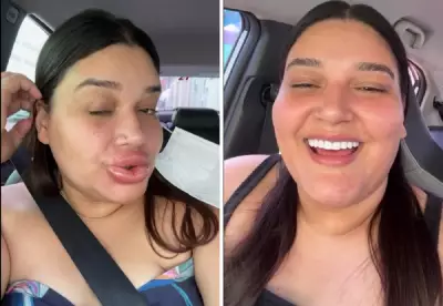 Maquiadora viraliza com lábios inchados após procedimento: susto e recuperação em 24h