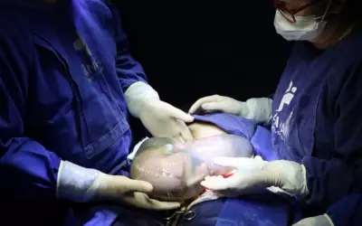 Trigêmeos nascem empelicados em Anápolis: parto raro emociona equipe