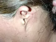 Ataque de rottweilers: 9 meses depois, vítima evita espelho e luta por casa própria