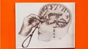 Lobotomia: a polêmica cirurgia que marcou a psiquiatria no século XX