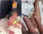 Mulher trans é agredida com garrafa de vidro durante festa em Boa Vista (RR)