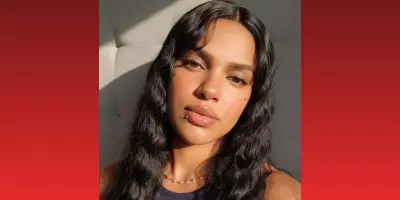 Funcionária de buffet com queimaduras graves é transferida após apelo da família em Mogi