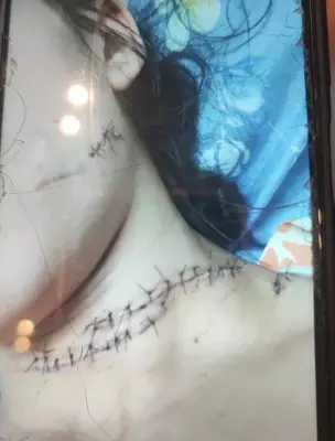 Homem invade casa e tenta matar ex-companheira a facadas no pescoço em Maceió