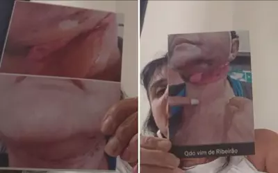 Laudo do IML confirma lesões graves em mais uma paciente de dentista de Ribeirão Preto