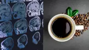 Estudo de Harvard e MIT revela que café pode reduzir risco de demência em até 20%