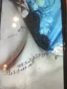 Homem invade casa e tenta matar ex-companheira a facadas no pescoço em Maceió