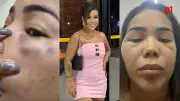 Influencer relata agressões por ex-namorado em Teresina e busca medida protetiva