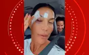 Ivete Sangalo recebe alta após desmaio por síncope vasovagal e brinca sobre hematomas