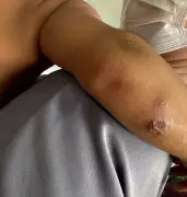 Mãe é presa por abandono e maus-tratos a filhos gêmeos de um ano em Alagoas