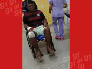 Ônibus tomba na BR-364 no Acre e deixa assessor parlamentar com fratura na coluna