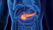 Pancreatite aguda: alerta britânico sobre risco com canetas GLP-1 como Ozempic