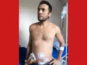 Professora acusa Saúde do Acre de negligência após diagnóstico tardio de apendicite do marido