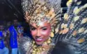 Rainha da Tuiuti, Mayara Lima, investe em procedimentos estéticos para brilhar no Carnaval