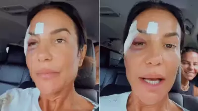 Ivete Sangalo confirma cirurgia após alta hospitalar e internação recente