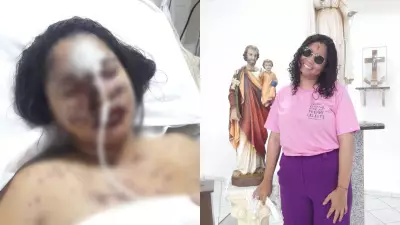 Jovem perde 95% da visão após reação alérgica grave e descobre síndrome rara no Piauí