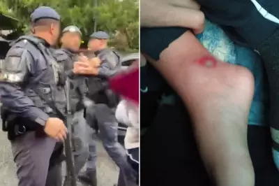 Menino de 3 anos tem pé atropelado por viatura da PM em Santos e policial ameaça família