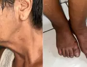 Aposentada de 70 anos é estuprada em Cabo Frio após ser imobilizada com golpe de gravata