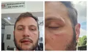 Estudantes da USP denunciam agressões por seguranças do vereador Lucas Pavanato